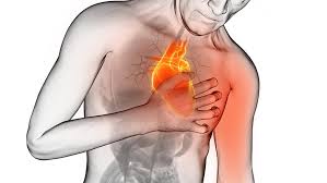 sintomas de infarto e avc, infarto ou avc, infarto e avc ao mesmo tempo, como evitar infarto e avc, infarto e avc são a mesma coisa, infarto e avc sintomas, infarto cerebral e avc