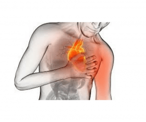 sintomas de infarto e avc, infarto ou avc, infarto e avc ao mesmo tempo, como evitar infarto e avc, infarto e avc são a mesma coisa, infarto e avc sintomas, infarto cerebral e avc